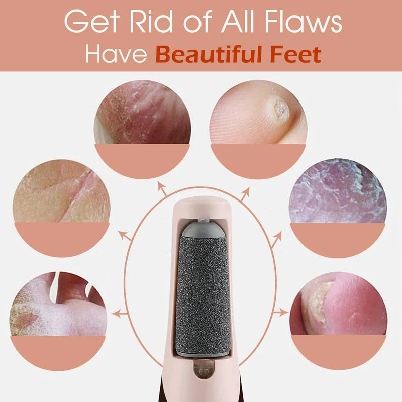 Electric Pedicure Foot File & Callus Remover