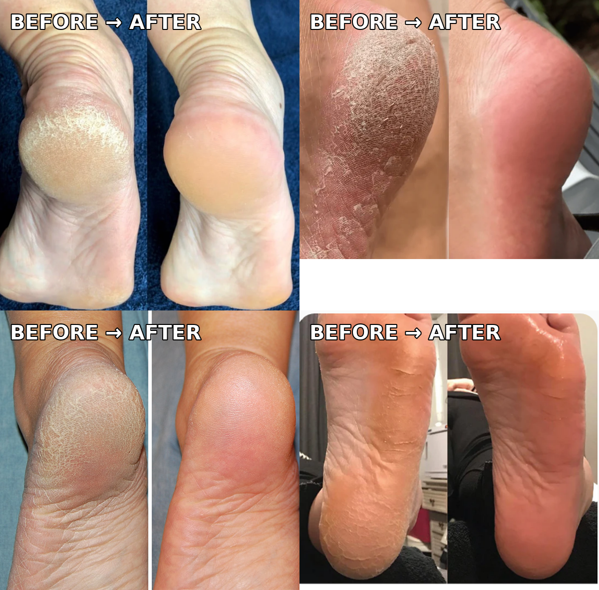 Electric Pedicure Foot File & Callus Remover