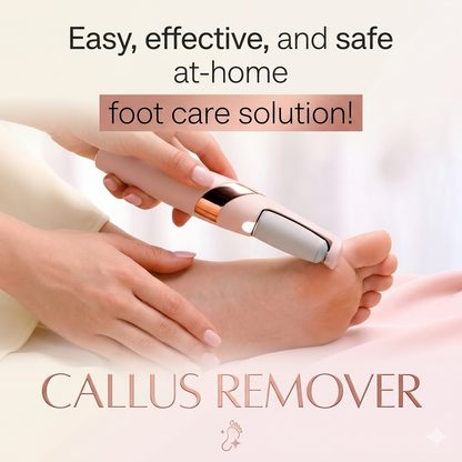 Electric Pedicure Foot File & Callus Remover