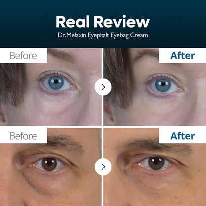 Imported Dr Melaxin - Eyephalt Eyecream