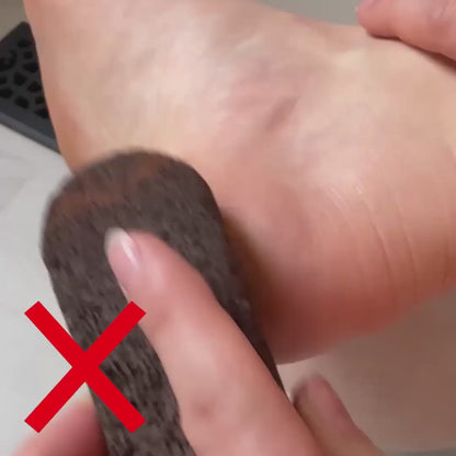 Electric Pedicure Foot File & Callus Remover